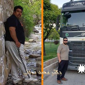 اسلیو معده 50