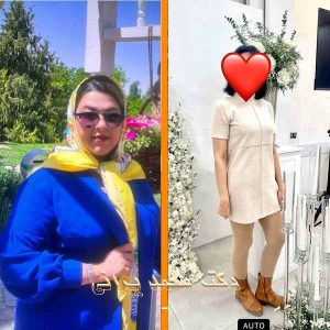 اسلیو معده 54