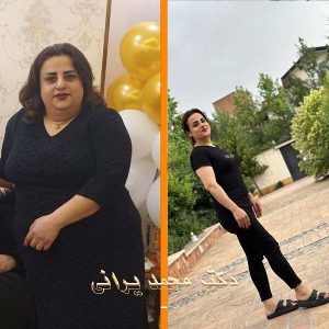 اسلیو معده 58