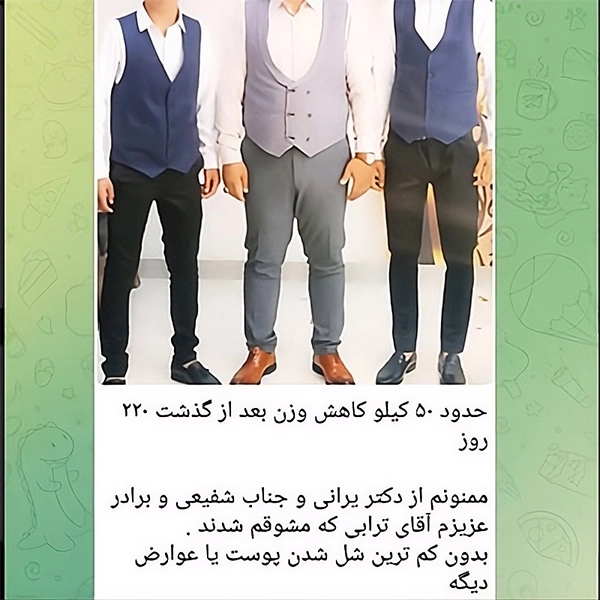 رضایت بیمار پس از عمل اسلیو معده توسط دکتر محمد یرانی