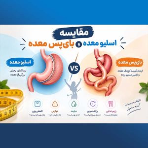 مقایسه اسلیو معده و بای‌پس معده